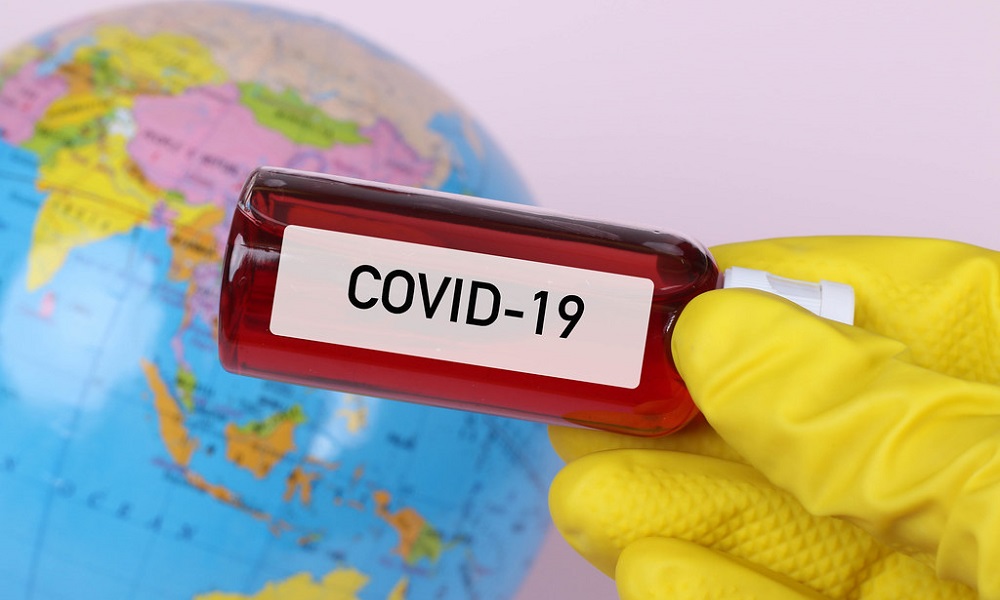 COVID-19
